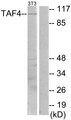 TAF4 Antibody - Western blot analysis of lysates from NIH/3T3 cells, using TAF4 Antibody. The lane on the right is blocked with the synthesized peptide.