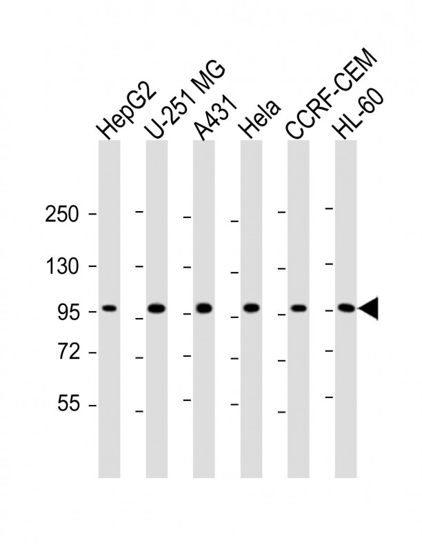 TAF4 Antibody - All lanes: Anti-TAF4 Antibody (C-Term) at 1:2000 dilution Lane 1: HepG2 whole cell lysate Lane 2: U-251 MG whole cell lysate Lane 3: A431 whole cell lysate Lane 4: Hela whole cell lysate Lane 5: CCRF-CEM whole cell lysate Lane 6: HL-60 whole cell lysate Lysates/proteins at 20 µg per lane. Secondary Goat Anti-Rabbit IgG, (H+L), Peroxidase conjugated at 1/10000 dilution. Predicted band size: 110 kDa Blocking/Dilution buffer: 5% NFDM/TBST.