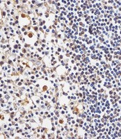TAF4 Antibody - TAF4 Antibody (C-Term) staining TAF4 in human tonsil tissue sections by Immunohistochemistry (IHC-P - paraformaldehyde-fixed, paraffin-embedded sections). Tissue was fixed with formaldehyde and blocked with 3% BSA for 0. 5 hour at room temperature; antigen retrieval was by heat mediation with a citrate buffer (pH6). Samples were incubated with primary antibody (1/25) for 1 hours at 37°C. A undiluted biotinylated goat polyvalent antibody was used as the secondary antibody.