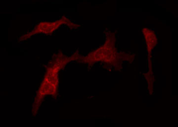 TAF4 Antibody - Staining NIH-3T3 cells by IF/ICC. The samples were fixed with PFA and permeabilized in 0.1% Triton X-100, then blocked in 10% serum for 45 min at 25°C. The primary antibody was diluted at 1:200 and incubated with the sample for 1 hour at 37°C. An Alexa Fluor 594 conjugated goat anti-rabbit IgG (H+L) Ab, diluted at 1/600, was used as the secondary antibody.