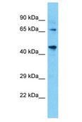 TAF4B Antibody - TAF4B antibody Western Blot of COLO205. Antibody dilution: 1 ug/ml.  This image was taken for the unconjugated form of this product. Other forms have not been tested.