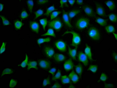 TAF4B Antibody - Immunofluorescence staining of A549 cells diluted at 1:166, counter-stained with DAPI. The cells were fixed in 4% formaldehyde, permeabilized using 0.2% Triton X-100 and blocked in 10% normal Goat Serum. The cells were then incubated with the antibody overnight at 4°C.The Secondary antibody was Alexa Fluor 488-congugated AffiniPure Goat Anti-Rabbit IgG (H+L).