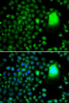 TAF5 Antibody - Immunofluorescence analysis of MCF7 cells.