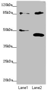 TAF5 Antibody - Western blot All Lanes: TAF5 antibody at 1.74 ug/ml Lane 1: Jurkat whole cell lysate Lane 2: MCF7 whole cell lysate Secondary Goat polyclonal to Rabbit IgG at 1/10000 dilution Predicted band size: 87,81 kDa Observed band size: 87 kDa,40 kDa,51 kDa
