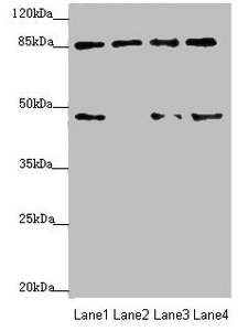 TAF5 Antibody - Western blot All Lanes: TAF5 antibody at 2.33ug/ml Lane 1: Jurkat whole cell lysate Lane 2: Hela whole cell lysate Lane 3: HepG-2 whole cell lysate Lane 4: MCF7 whole cell lysate Secondary Goat polyclonal to Rabbit IgG at 1/10000 dilution Predicted band size: 87,81 kDa Observed band size: 87 kDa,45 kDa