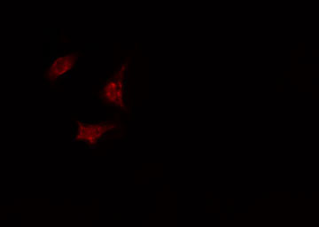 TAF5 Antibody - Staining A549 cells by IF/ICC. The samples were fixed with PFA and permeabilized in 0.1% Triton X-100, then blocked in 10% serum for 45 min at 25°C. The primary antibody was diluted at 1:200 and incubated with the sample for 1 hour at 37°C. An Alexa Fluor 594 conjugated goat anti-rabbit IgG (H+L) antibody, diluted at 1/600, was used as secondary antibody.