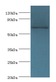 TAF5L Antibody - Western blot. All lanes: TAF5L antibody at 10 ug/ml+Jurkat whole cell lysate. Secondary antibody: Goat polyclonal to rabbit at 1:10000 dilution. Predicted band size: 66 kDa. Observed band size: 66 kDa.