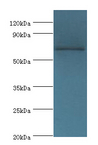 TAF5L Antibody - Western blot. All lanes: TAF5L antibody at 10 ug/ml+Jurkat whole cell lysate. Secondary antibody: Goat polyclonal to rabbit at 1:10000 dilution. Predicted band size: 66 kDa. Observed band size: 66 kDa.