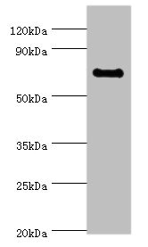 TAF5L Antibody - Western blot All lanes: TAF5L antibody at 10µg/ml + Jurkat whole cell lysate Secondary Goat polyclonal to rabbit IgG at 1/10000 dilution Predicted band size: 67, 37 kDa Observed band size: 67 kDa
