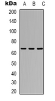 TAF5L Antibody - Western blot analysis of TAF5L expression in Jurkat (A); HT29 (B); COS7 (C) whole cell lysates.