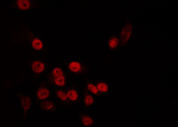 TAF5L Antibody - Staining HT29 cells by IF/ICC. The samples were fixed with PFA and permeabilized in 0.1% Triton X-100, then blocked in 10% serum for 45 min at 25°C. The primary antibody was diluted at 1:200 and incubated with the sample for 1 hour at 37°C. An Alexa Fluor 594 conjugated goat anti-rabbit IgG (H+L) Ab, diluted at 1/600, was used as the secondary antibody.