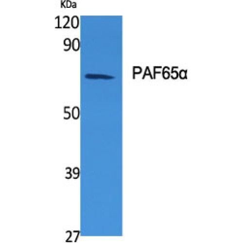 TAF6L Antibody - Western blot of PAF65alpha antibody