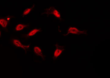 TAF6L Antibody - Staining 293 cells by IF/ICC. The samples were fixed with PFA and permeabilized in 0.1% Triton X-100, then blocked in 10% serum for 45 min at 25°C. The primary antibody was diluted at 1:200 and incubated with the sample for 1 hour at 37°C. An Alexa Fluor 594 conjugated goat anti-rabbit IgG (H+L) Ab, diluted at 1/600, was used as the secondary antibody.