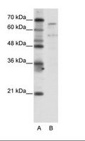 TAF6L Antibody - A: Marker, B: Jurkat Cell Lysate.  This image was taken for the unconjugated form of this product. Other forms have not been tested.