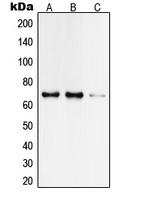 TAF6L Antibody - Western blot analysis of TAF6L expression in HeLa (A); Jurkat (B); rat brain (C) whole cell lysates.