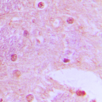 TAF6L Antibody - Immunohistochemical analysis of TAF6L staining in human brain formalin fixed paraffin embedded tissue section. The section was pre-treated using heat mediated antigen retrieval with sodium citrate buffer (pH 6.0). The section was then incubated with the antibody at room temperature and detected using an HRP conjugated compact polymer system. DAB was used as the chromogen. The section was then counterstained with hematoxylin and mounted with DPX.