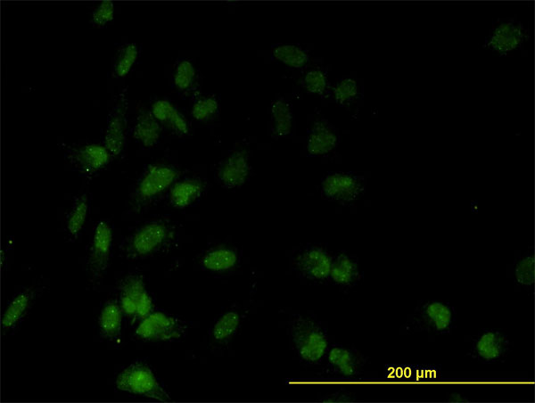 TAF7 Antibody - Immunofluorescence of monoclonal antibody to TAF7 on HeLa cell. [antibody concentration 10 ug/ml]