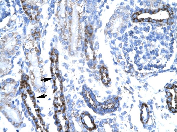TAF7 Antibody - TAF7 antibody P100967_T100-NP_005633-TAF7 (TAF7 RNA polymerase II, TATA box binding protein (TBP)-associated factor, 55kDa) Antibody was used in IHC to stain formalin-fixed, paraffin-embedded human kidney.  This image was taken for the unconjugated form of this product. Other forms have not been tested.