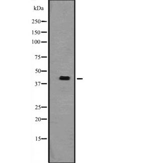 TAF7L Antibody - Western blot analysis of TAF7L expression in SP2\0 cells lysate. The lane on the left is treated with the antigen-specific peptide.