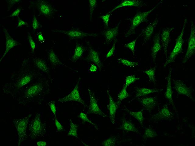 TAF7L Antibody - Immunofluorescence staining of TAF7L in Hela cells. Cells were fixed with 4% PFA, permeabilzed with 0.1% Triton X-100 in PBS, blocked with 10% serum, and incubated with rabbit anti-Human TAF7L polyclonal antibody (dilution ratio 1:200) at 4°C overnight. Then cells were stained with the Alexa Fluor 488-conjugated Goat Anti-rabbit IgG secondary antibody (green). Positive staining was localized to Nucleus and Cytoplasm.