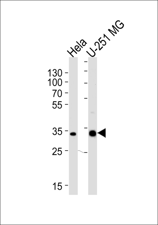 TAF8 Antibody - Western blot of lysates from HeLa, U-251 MG cell line (from left to right), using TAF8 Antibody. Antibody was diluted at 1:1000 at each lane. A goat anti-rabbit IgG H&L (HRP) at 1:5000 dilution was used as the secondary antibody. Lysates at 35ug per lane.