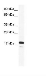 TAF9 Antibody - Fetal Small intestine Lysate.  This image was taken for the unconjugated form of this product. Other forms have not been tested.