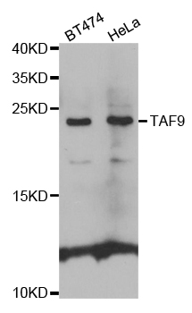 TAF9 Antibody - Western blot analysis of extracts of various cell lines.