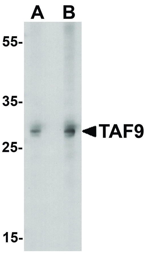 TAF9 Antibody - Western blot analysis of TAF9 in HepG2 cell lysate with TAF9 antibody at (A) 1 and (B) 2ug/ml.