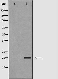 TAF9 Antibody - Western blot analysis of HepG2 whole cells lysates using TAF9 antibody. The lane on the left is treated with the antigen-specific peptide.