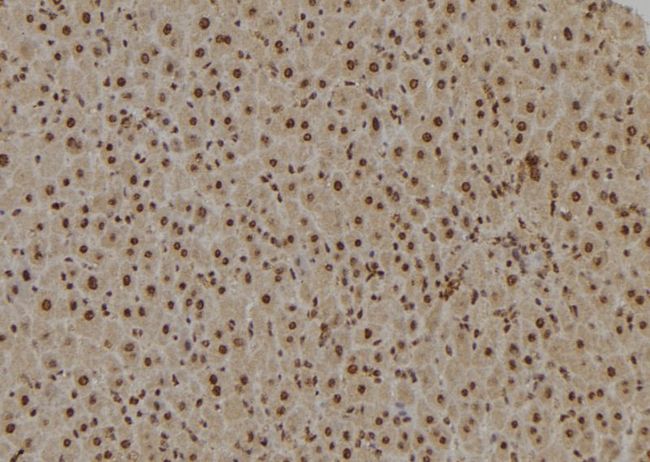 TAF9 Antibody - 1:100 staining mouse liver tissue by IHC-P. The sample was formaldehyde fixed and a heat mediated antigen retrieval step in citrate buffer was performed. The sample was then blocked and incubated with the antibody for 1.5 hours at 22°C. An HRP conjugated goat anti-rabbit antibody was used as the secondary.