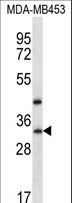 TAF9B Antibody - TAF9B Antibody western blot of MDA-MB453 cell line lysates (35 ug/lane). The TAF9B antibody detected the TAF9B protein (arrow).
