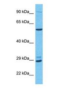 TAF9B Antibody - Western blot of TAF9B Antibody with human Fetal Liver lysate.  This image was taken for the unconjugated form of this product. Other forms have not been tested.