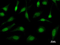 TAF9B Antibody - Immunostaining analysis in HeLa cells. HeLa cells were fixed with 4% paraformaldehyde and permeabilized with 0.1% Triton X-100 in PBS. The cells were immunostained with anti-TAF9L mAb.