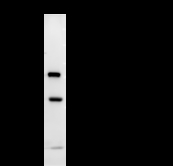 TAFII70 / TAF6 Antibody - Immunoprecipitation: RIPA lysate of HeLa cells was incubated with anti-TAF6 mAb. Predicted molecular weight: 72 kDa