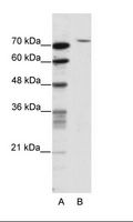 TAFII70 / TAF6 Antibody - A: Marker, B: HepG2 Cell Lysate.  This image was taken for the unconjugated form of this product. Other forms have not been tested.