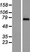 TAFII70 / TAF6 Protein - Western validation with an anti-DDK antibody * L: Control HEK293 lysate R: Over-expression lysate
