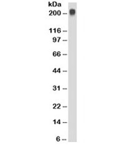 TAG-72 Antibody - Westen blot testing of Jurkat cell lysate with TAG-72 antibody (clone CC49). Expected molecular weight ~220kDa.