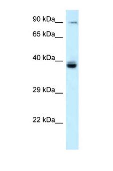 TAGAP Antibody - TAGAP antibody Western blot of Fetal Liver lysate. Antibody concentration 1 ug/ml.  This image was taken for the unconjugated form of this product. Other forms have not been tested.