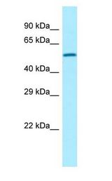 TAGAP Antibody - TAGAP antibody Western Blot of MCF7.  This image was taken for the unconjugated form of this product. Other forms have not been tested.