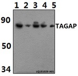 TAGAP Antibody - Western blot of TAGAP polyclonal antibody at 1:500 dilution. Lane 1: HeLa whole cell lysate (40 ug). Lane 2: PC12 whole cell lysate (40 ug). Lane 3: RAW264.7 whole cell lysate (40 ug). Lane 4: MCF-7 whole cell lysate (40 ug). Lane 5: H9C2 whole cell lysate (40 ug).