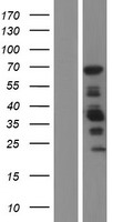 TAGAP Protein - Western validation with an anti-DDK antibody * L: Control HEK293 lysate R: Over-expression lysate