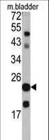 TAGLN / Transgelin / SM22 Antibody - Western blot of TAGLN antibody in mouse bladder tissue lysates (35 ug/lane). TAGLN (arrow) was detected using the purified antibody.