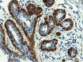TAGLN / Transgelin / SM22 Antibody - IHC of paraffin-embedded Human breast tissue using anti-TAGLN mouse monoclonal antibody.