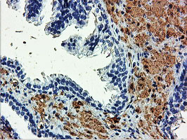 TAGLN / Transgelin / SM22 Antibody - IHC of paraffin-embedded Human prostate tissue using anti-TAGLN mouse monoclonal antibody.
