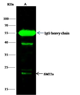 TAGLN / Transgelin / SM22 Antibody - SM22a was immunoprecipitated using: Lane A: 0.5 mg Jurkat Whole Cell Lysate. 1 uL anti-SM22a rabbit polyclonal antibody and 15 ul of 50% Protein G agarose. Primary antibody: Anti-SM22a rabbit polyclonal antibody, at 1:500 dilution. Secondary antibody: Dylight 800-labeled antibody to rabbit IgG (H+L), at 1:5000 dilution. Developed using the odssey technique. Performed under reducing conditions. Predicted band size: 23 kDa. Observed band size: 23 kDa.