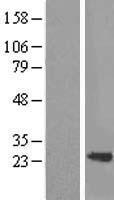TAGLN / Transgelin / SM22 Protein - Western validation with an anti-DDK antibody * L: Control HEK293 lysate R: Over-expression lysate