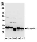 TAGLN2 / Transgelin 2 Antibody - Detection of human and mouse Transgelin 2 by western blot. Samples: Whole cell lysate (50 µg) from HeLa, HEK293T, Jurkat, mouse TCMK-1, and mouse NIH 3T3 cells prepared using NETN lysis buffer. Antibodies: Affinity purified rabbit anti-Transgelin 2 antibody used for WB at 0.1 µg/ml. Detection: Chemiluminescence with an exposure time of 10 seconds.