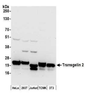 TAGLN2 / Transgelin 2 Antibody - Detection of human and mouse Transgelin 2 by western blot. Samples: Whole cell lysate (50 µg) from HeLa, HEK293T, Jurkat, mouse TCMK-1, and mouse NIH 3T3 cells prepared using NETN lysis buffer. Antibodies: Affinity purified rabbit anti-Transgelin 2 antibody used for WB at 0.1 µg/ml. Detection: Chemiluminescence with an exposure time of 10 seconds.