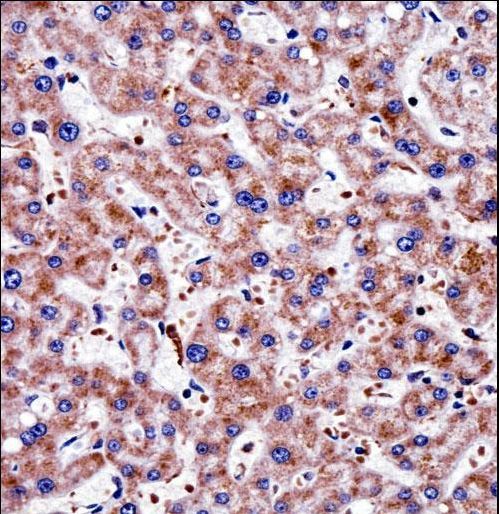TAGLN2 / Transgelin 2 Antibody - TAGLN2 Antibody immunohistochemistry of formalin-fixed and paraffin-embedded human liver tissue followed by peroxidase-conjugated secondary antibody and DAB staining.