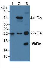 TAGLN2 / Transgelin 2 Antibody - Western Blot; Sample: Lane1: Human 293T Cells; Lane2: Porcine Heart Tissue; Lane3: Porcine Kidney Tissue.